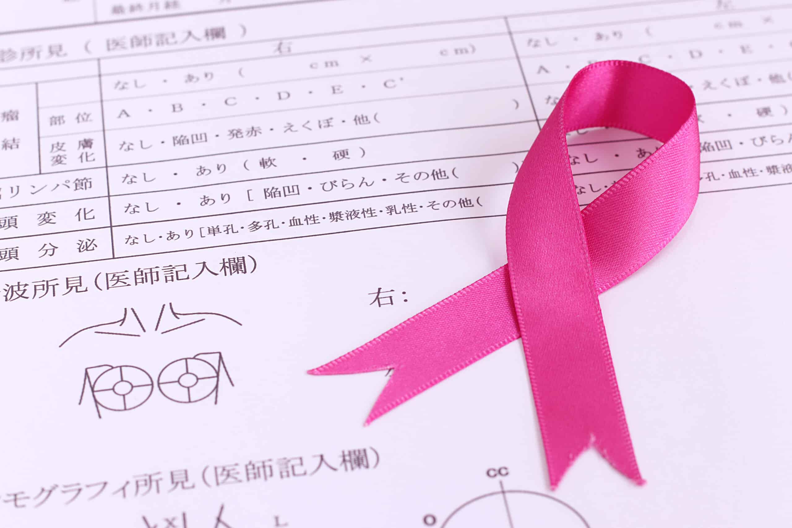 乳がん検診のイメージ