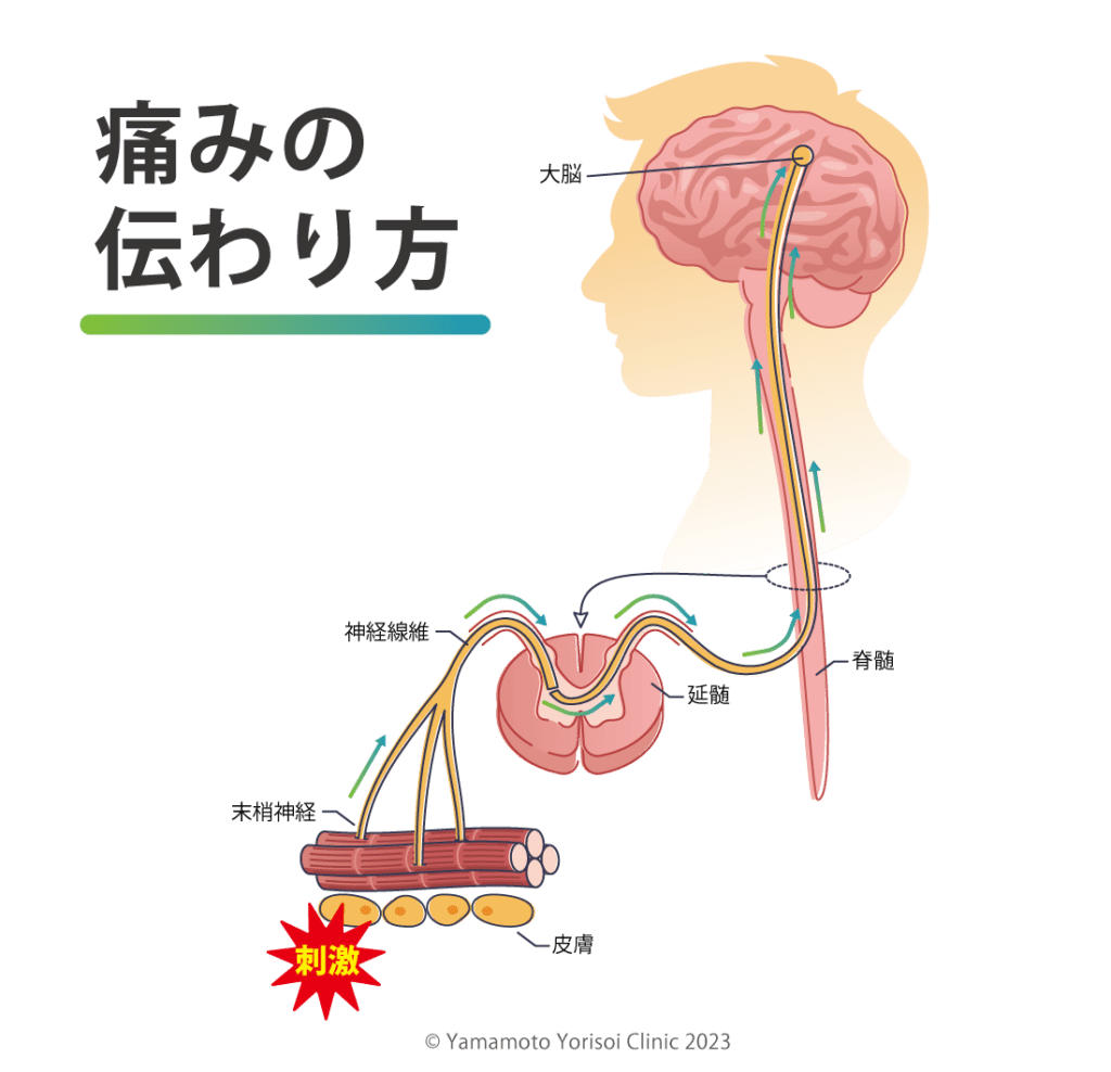 痛みの伝わり方